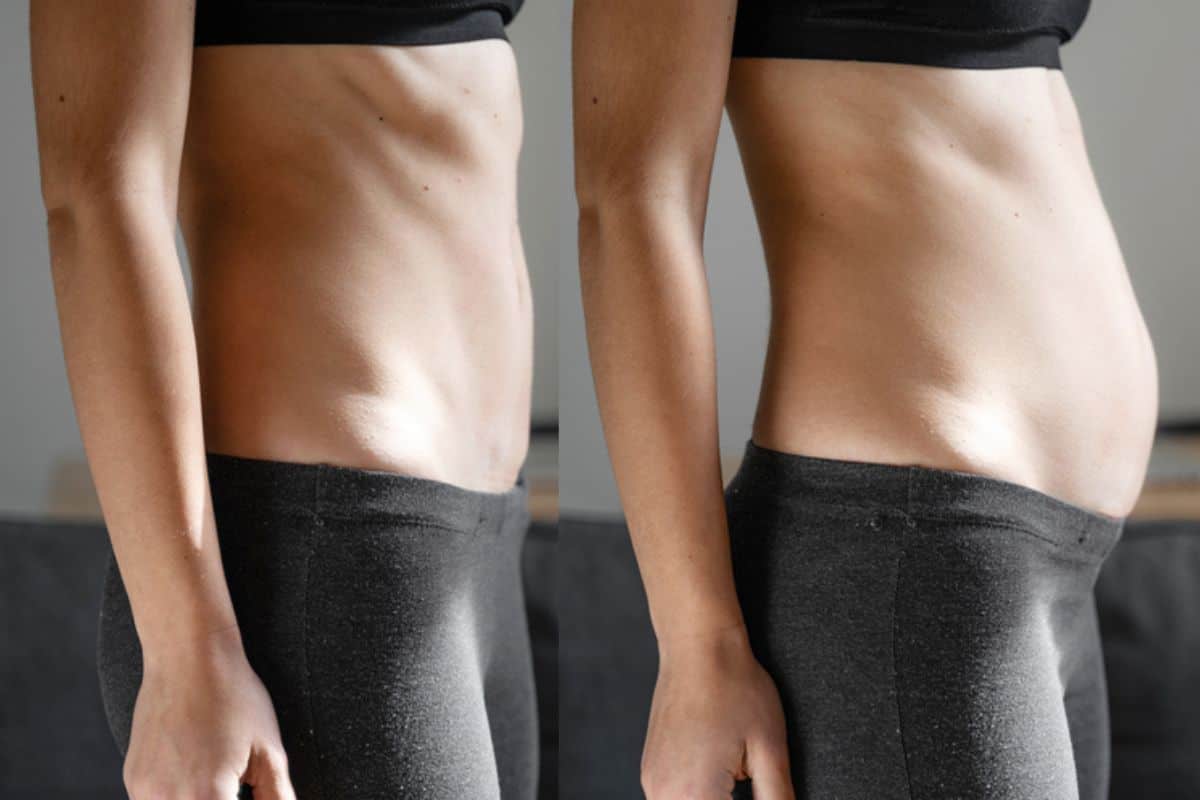 How long does diastasis recti take to improve Hampton Court?
