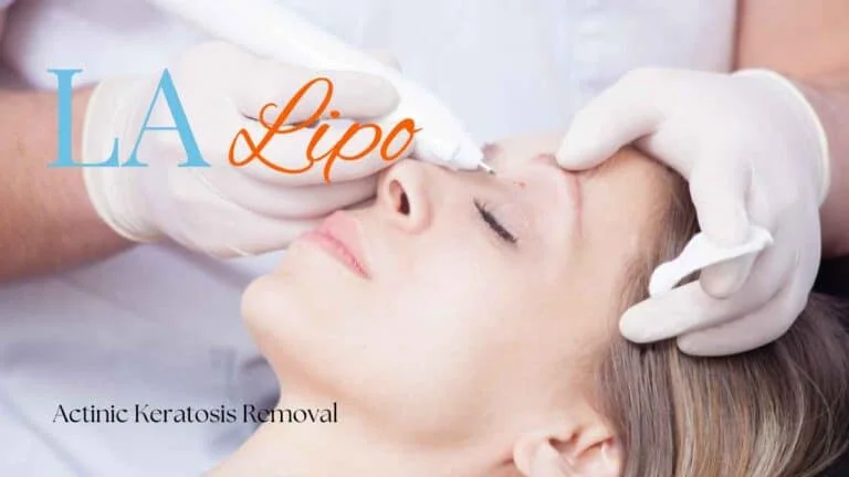 Woman receiving Actinic Keratosis Removal Treatment Hampton Court