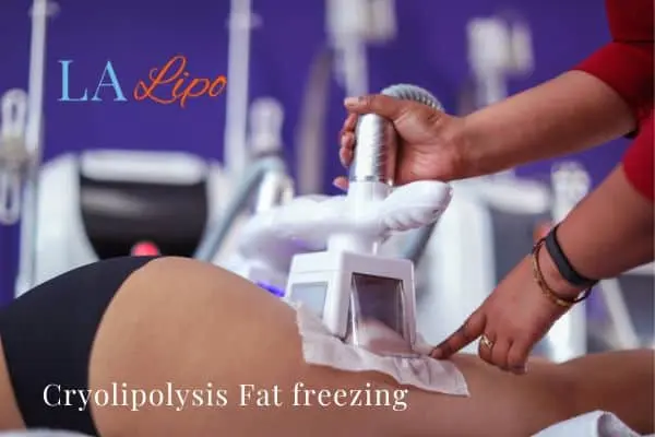 women getting fat freezing Hampton Court
