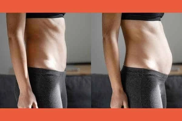 LA-EMS Body Sculpting results Hampton Court