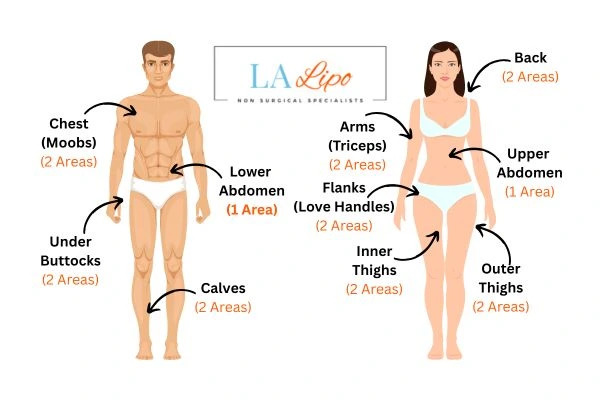 LA LIPO Cryolipolysis Areas Hampton Court