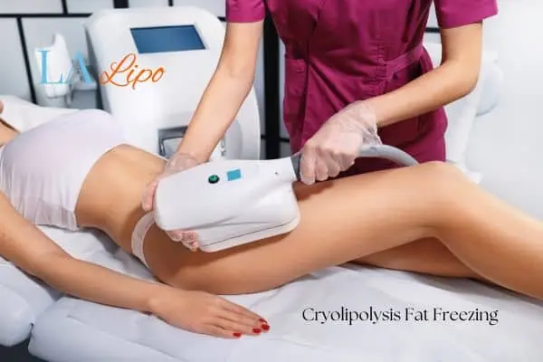 Woman receiving coolsculpting Hampton Court treatment on her thighs