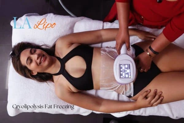 woman getting cryolipolysis Hampton Court