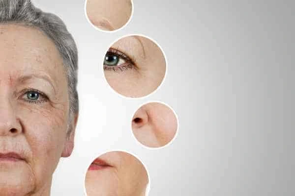 HIFU Facelift Hampton Court from LA LIPO