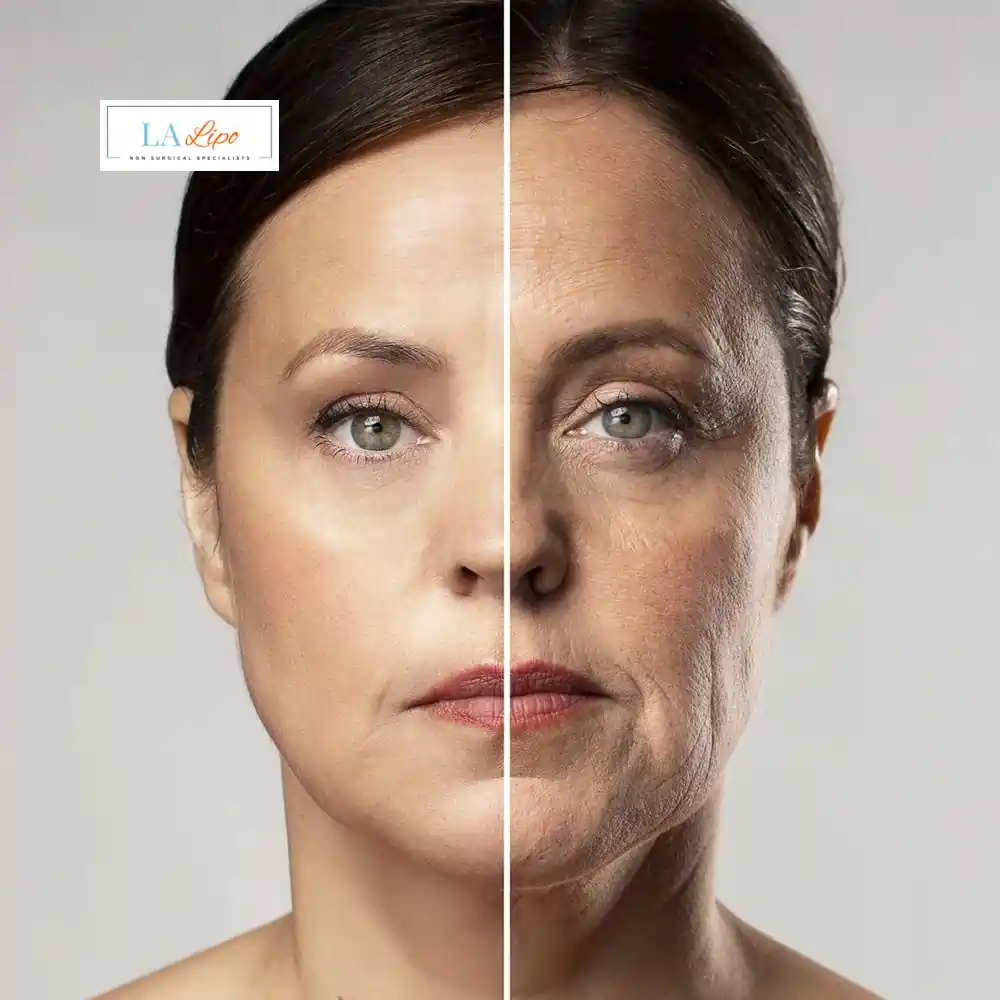 How Can You Tell If Non-Surgical Skin Tightening Is Right for You Hampton Court?