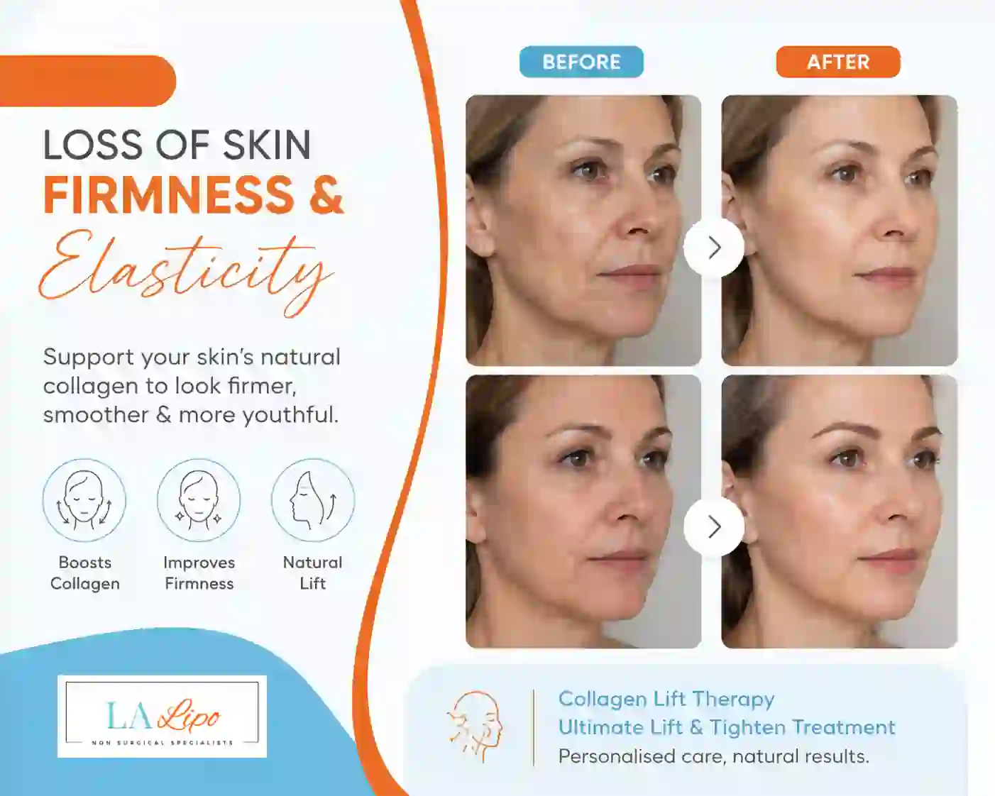 Sign #7: Loss of Skin Firmness and Elasticity Hampton Court