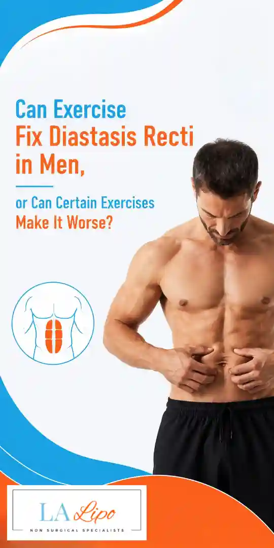 Can Exercise Fix Diastasis Recti in Men, or Can Certain Exercises Make It Worse Hampton Court?